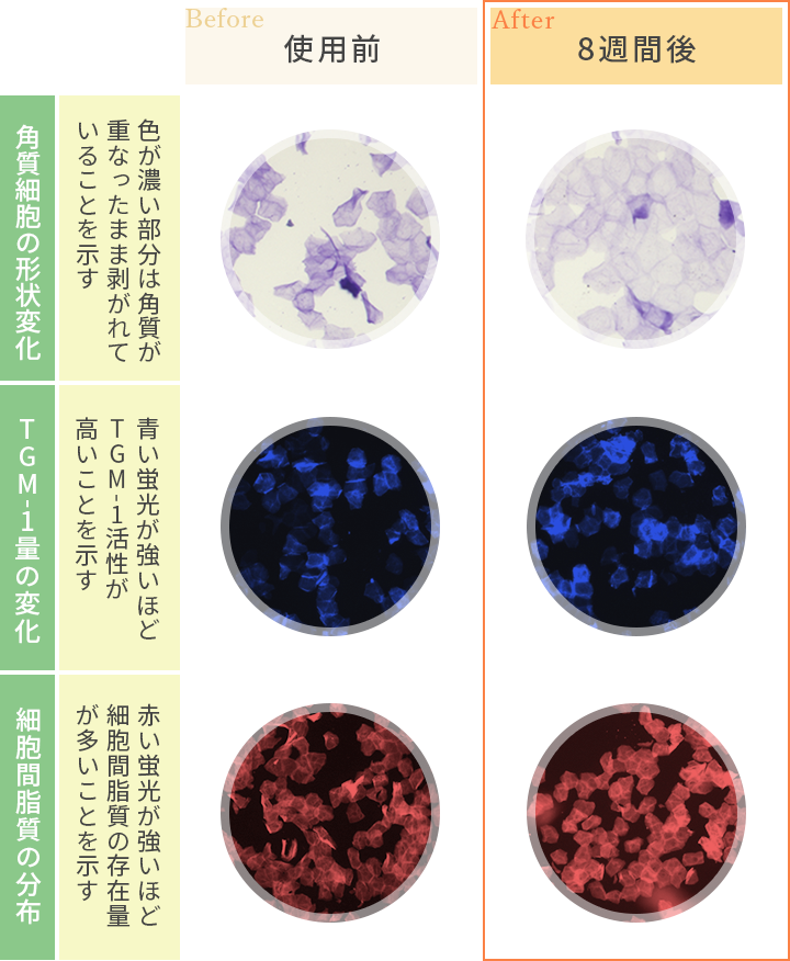 著効例(角層分析結果) 説明画像